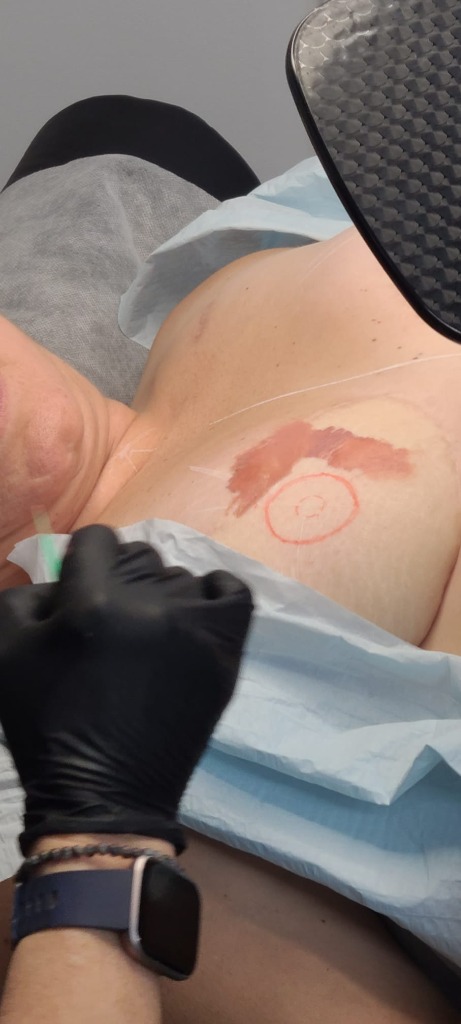 Restorative Pre-Treatment