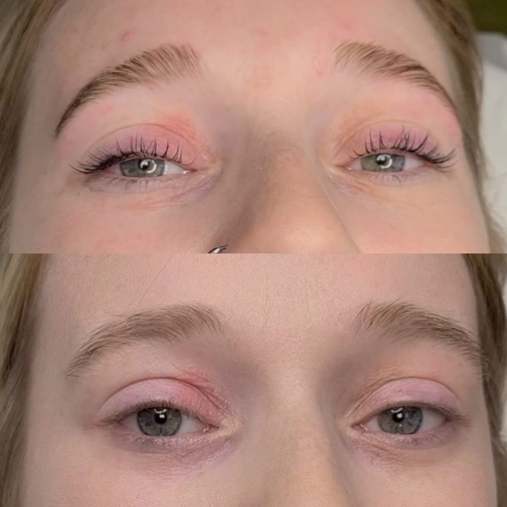 Bilateral Lash Lift