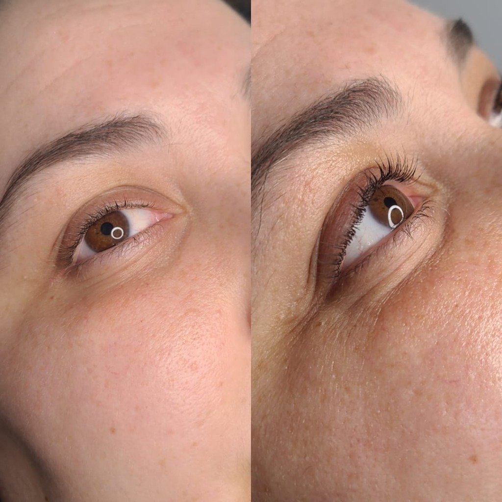 Lash Lift