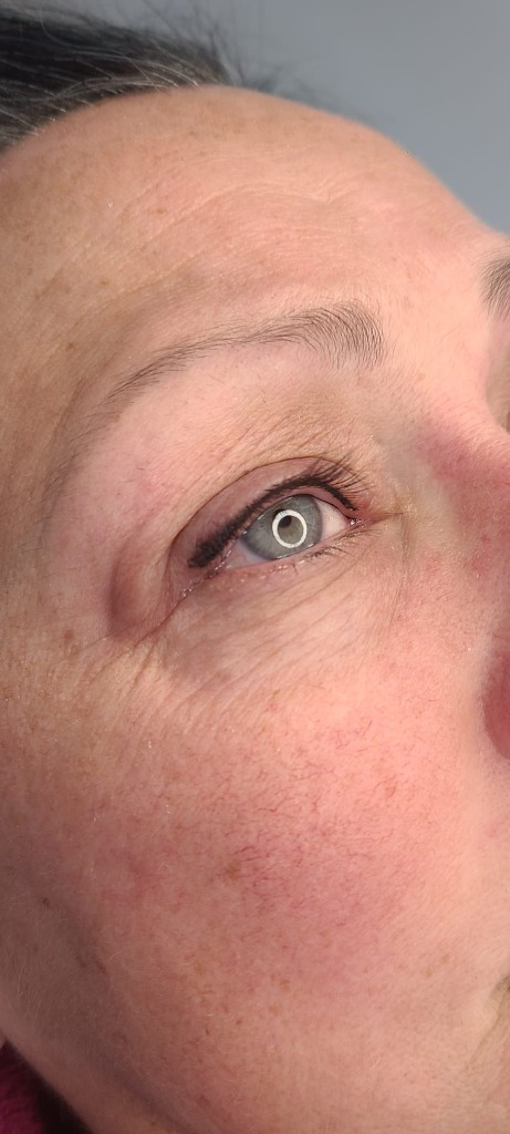 Eyeliner Enhancement