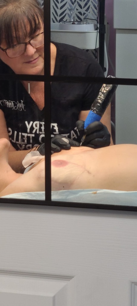 Surgical Scar Camouflage