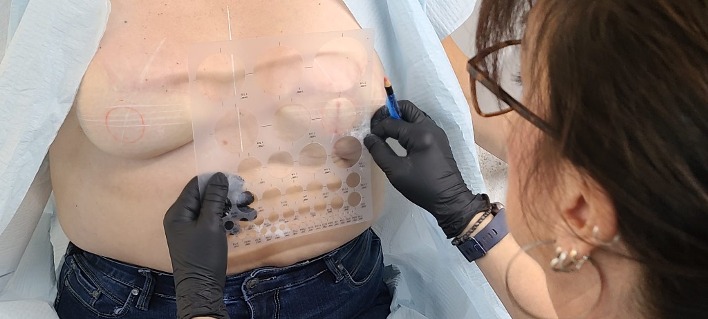 Areola Restoration